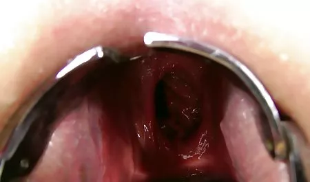 Exchange 03 lezbiyen erotik sex açısından